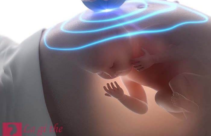 Yolksac là gì – Mang ý nghĩa như thế nào trong việc mang thai