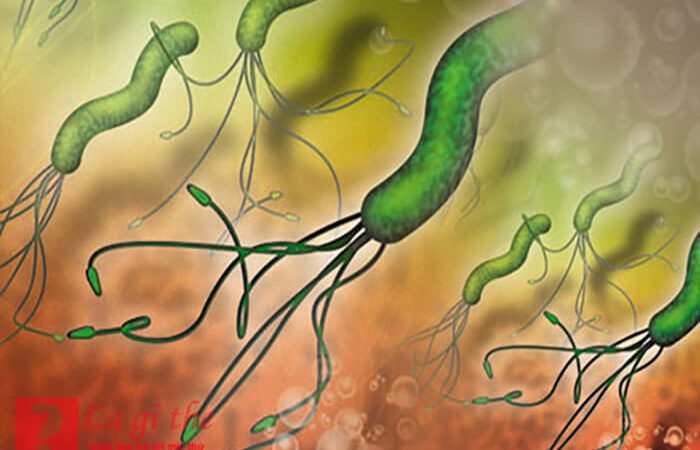 Virus h.pylori là gì – Nguyên nhân và tác hại của nó với cơ thể chúng ta